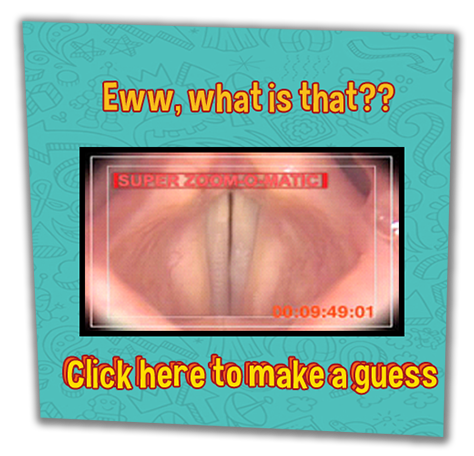 Eww, what is that? Picture shows something that looks like the inside of a human body.  Click to make a guess!